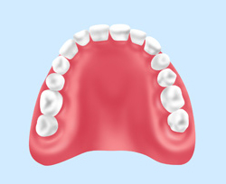 総入れ歯（義歯）